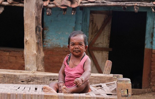 Ông Basori Lal sống tại bang Madhya Pradesh, Ấn Độ được dân làng coi là " người đàn ông kỳ lạ" bởi tuy đã 50 tuổi nhưng vẫn trong hình hài của một đứa trẻ với chiều cao vô cùng khiêm tốn 74cm.